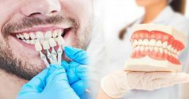 De ce se aplică furnirul de zirconiu pe dinți? Cât de rezistent este stratul de zirconiu?