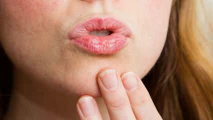Cum să îngrijești buzele acasă? Îngrijire ușoară uscată a buzelor în 4 pași