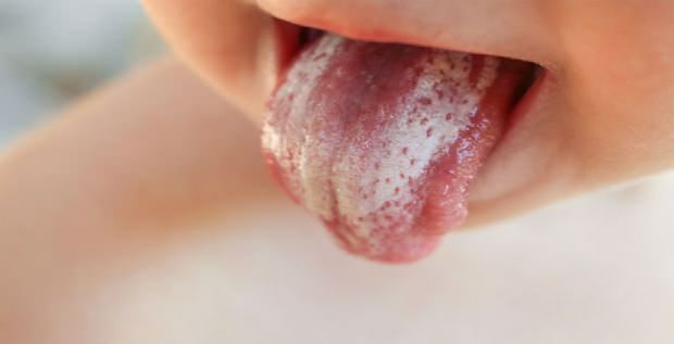 Tratament fungic oral la sugari