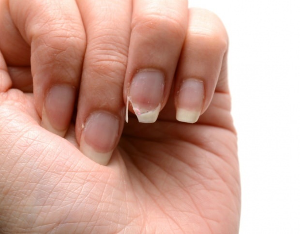 Cum se face îngrijirea unghiilor? Metode rapide de extensie a unghiilor