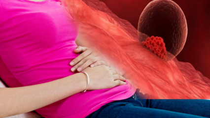 Ce este sângerarea implantată în timpul sarcinii? Cum se distinge sângerarea plasamentară de sângerarea menstruală