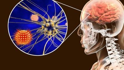 Ce este meningita și care sunt simptomele acesteia? Există un tratament pentru meningită?